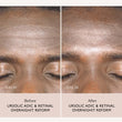 Load image into Gallery viewer, Ursolic Acid & Retinal Overnight Reform - 30ml
