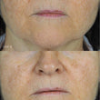 Load image into Gallery viewer, Triphala Pigmentation Corrector - 60ml