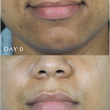 Load image into Gallery viewer, Triphala Pigmentation Corrector - 60ml