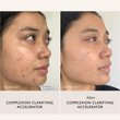 Load image into Gallery viewer, Complexion Clarifying Accelerator - 30ml