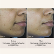 Load image into Gallery viewer, Triphala Pigmentation Corrector - 30ml
