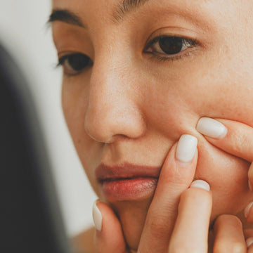 Are You Purging or Breaking Out? How to Tell, and What to Do Next