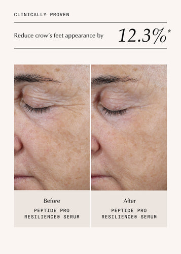 Peptide Pro Resilience® Serum Concentrate - 60ml