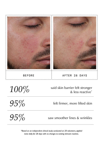 Peptide Pro Resilience® Serum Concentrate - 60ml