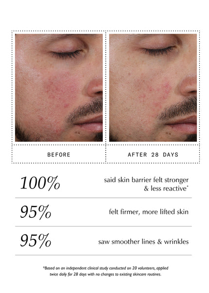 Peptide Pro Resilience® Serum Concentrate - 60ml