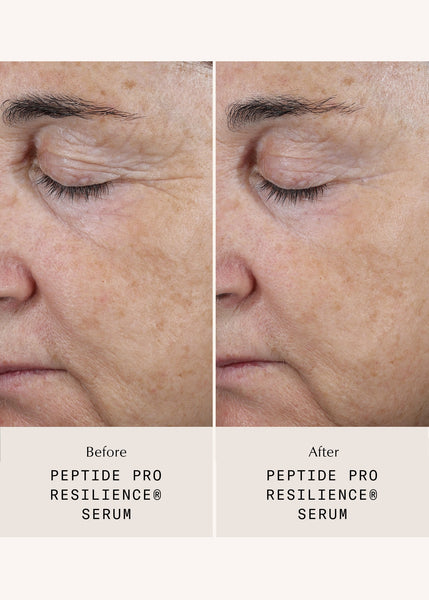 Peptide Pro Resilience® Serum Concentrate - 30ml