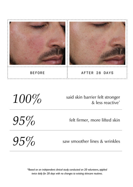 Peptide Pro Resilience® Serum Concentrate - 30ml