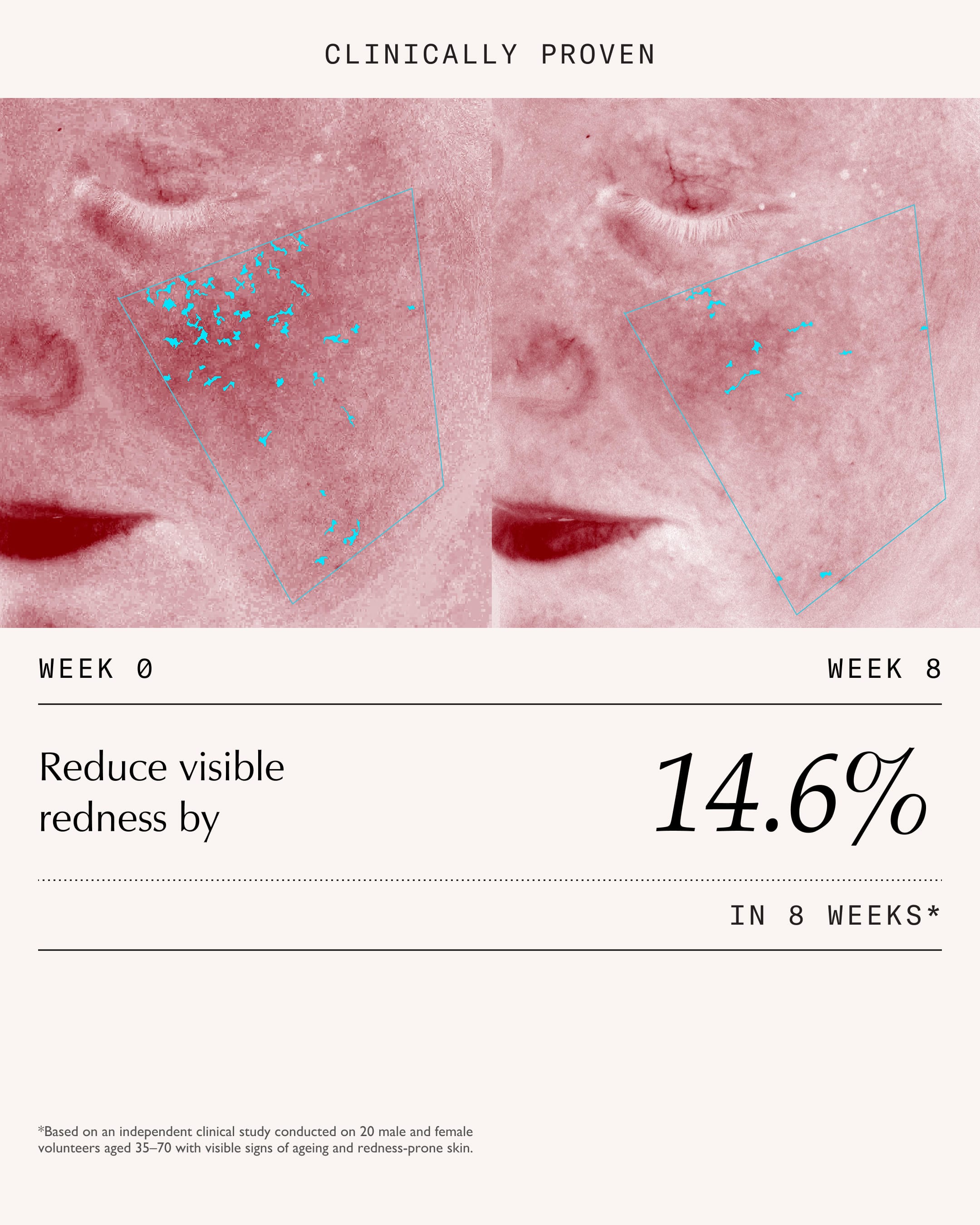 Threading Aftercare: What to Do (and Avoid) Right After – Sachi Skin