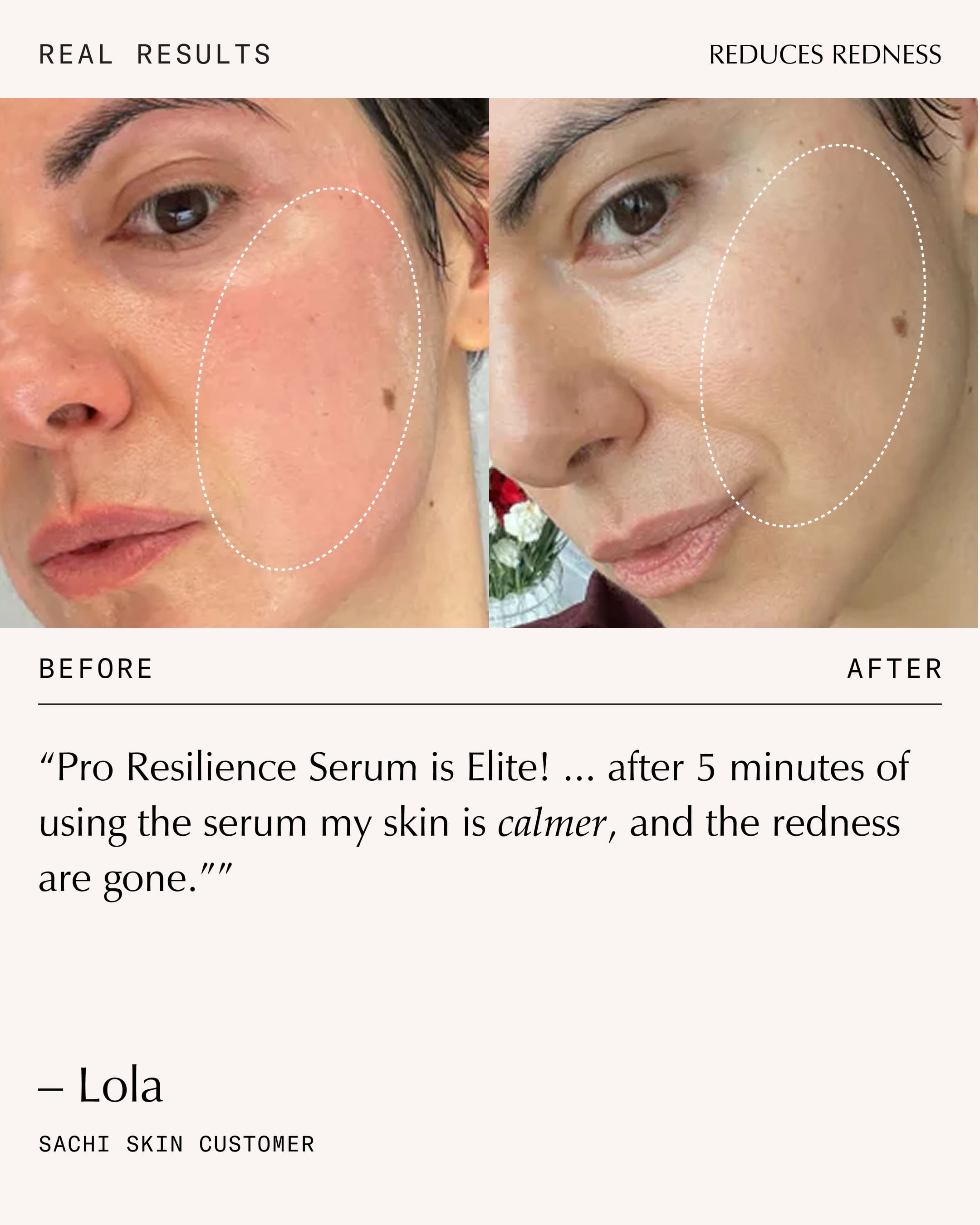 Peptide Pro Resilience® Serum | Barrier Repair Serum – Sachi Skin