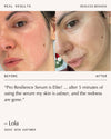 Peptide Pro Resilience® Serum Concentrate - 60ml