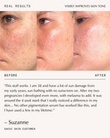 Triphala Pigmentation Corrector - 30ml