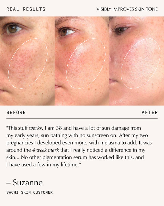 Triphala Pigmentation Corrector - 30ml