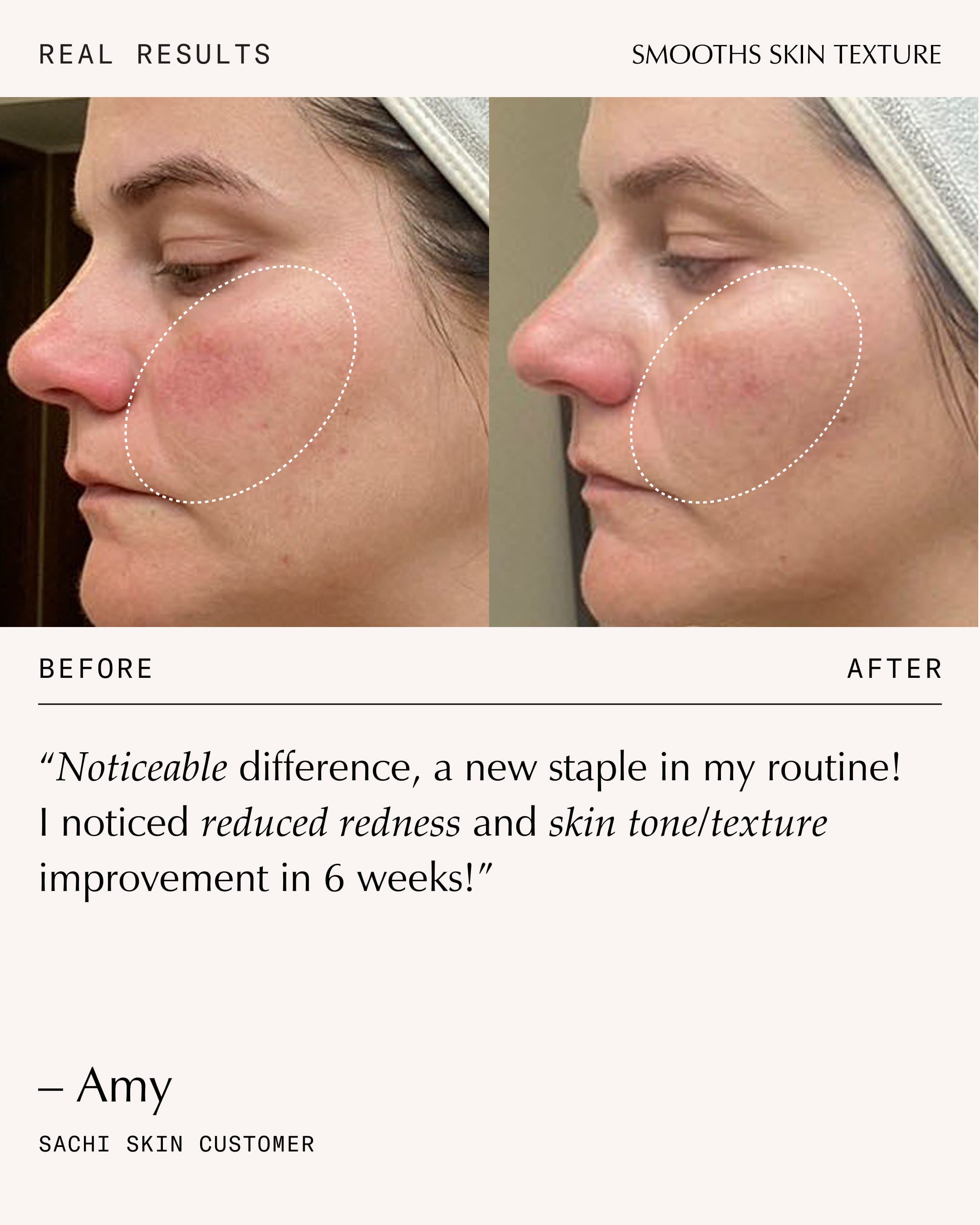 Peptide Pro Resilience® Serum | Barrier Repair Serum – Sachi Skin