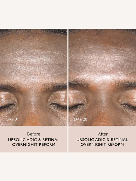 Ursolic Acid & Retinal Overnight Reform - 30ml