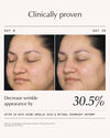 The Hyperpigmentation Edit